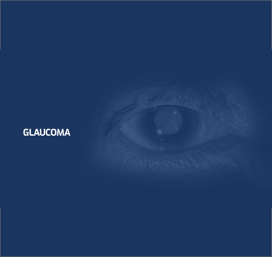 Glaucoma